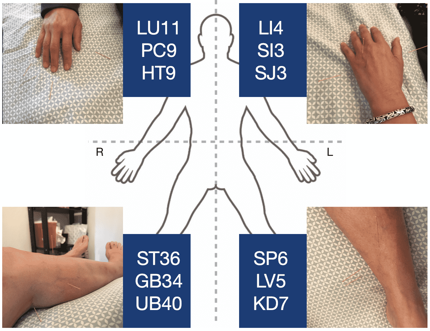 the academy of Acupuncture Case studies stage 4 kidney diseasse